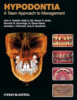 Hypodontia: A Team Approach To Management