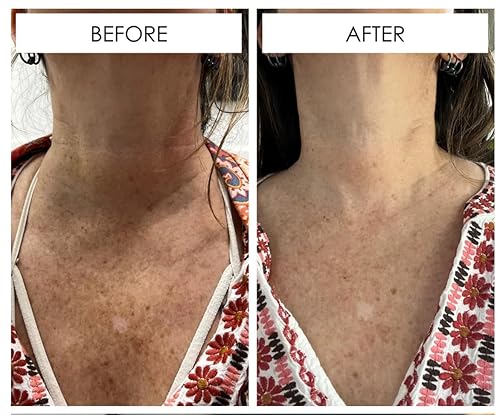 Miniatura 3 de In Your Face Suero de vitamina C – Suero facial hidratante e iluminador de vitamina C con ácido hialurónico, hongo shiitake, aceite de jojoba y MSM