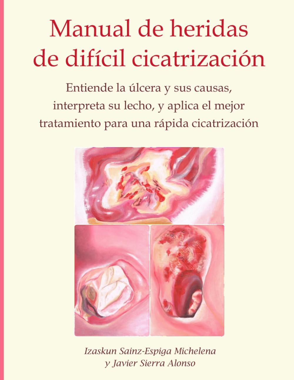 Manual de heridas de difícil cicatrización: Entiende la úlcera y sus causas, interpreta su lecho, y aplica el mejor tratamiento para una rápida cicatrización