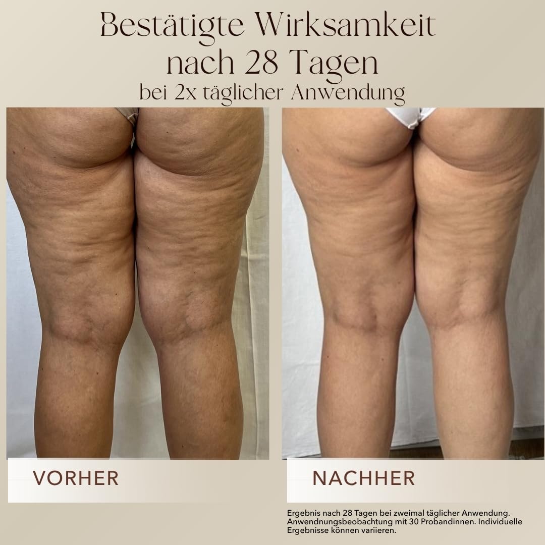 mellow NOIR Body Contour Cream 200ml – Körpercreme gegen Cellulite und Schlaffe Haut – Für feste Konturen an Bauch, Beinen und Oberarmen – zieht schnell ein ohne zu fetten – Naturkosmetik - vegan