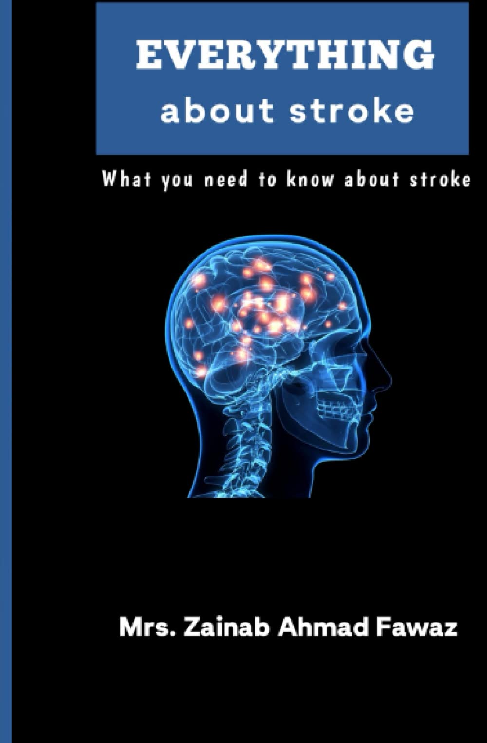 Everything about stroke: What you need to know about stroke