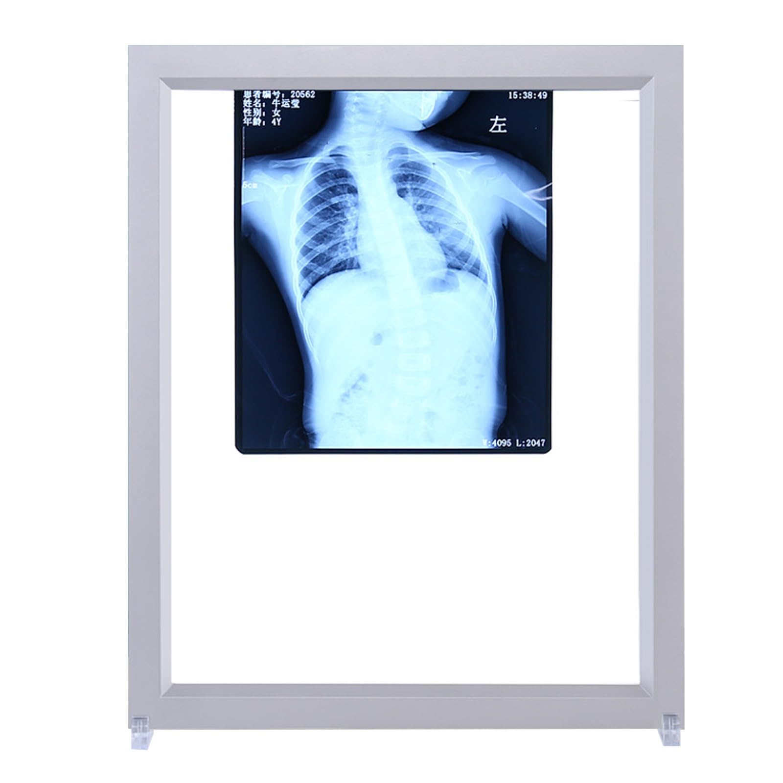 Amazon.co.jp: X線フィルムライトボックス X線ビューアー LEDライト