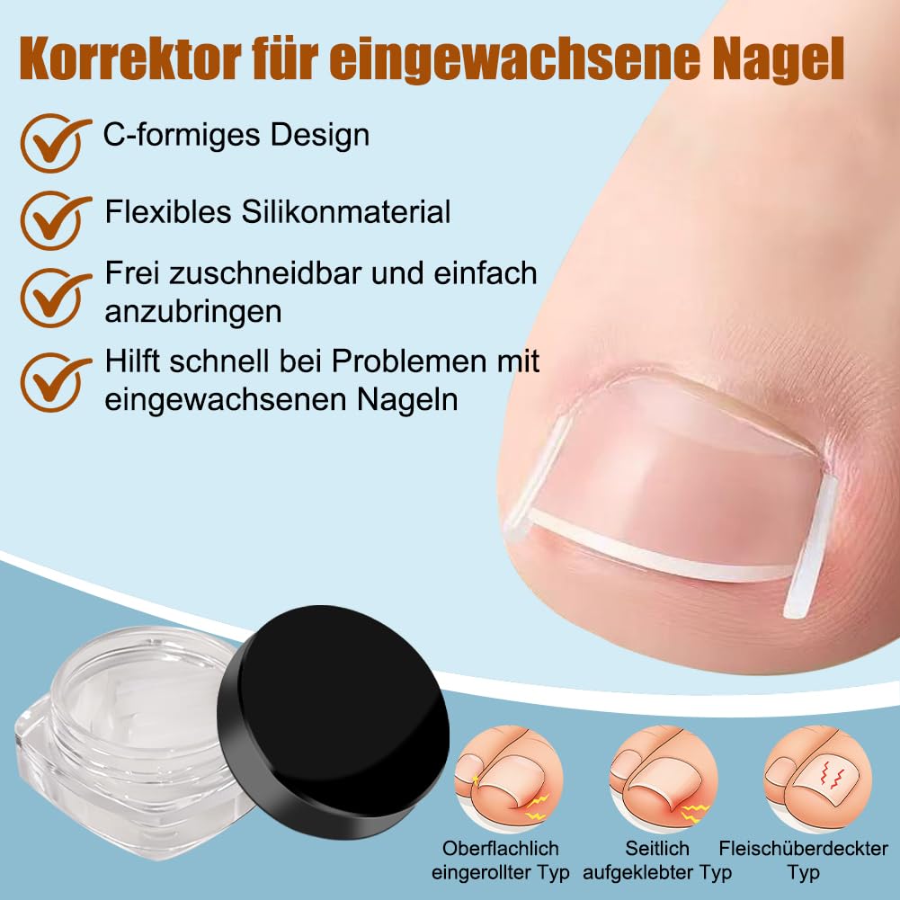 Zestaw do korekcji wrastających paznokci u stóp, 139 sztuk, z łatką do korekcji paznokci u stóp, wkładki do paznokci w kształcie litery C, zestaw narzędzi do pielęgnacji stóp – obcinacz do paznokci