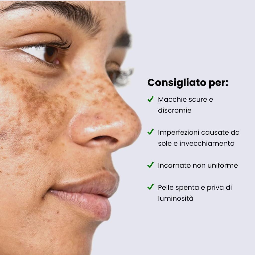 Gel Viso Anti-Età Notte: Riduce Macchie Scure e Pori Dilatati – Uniforma il Tono e Minimizza Imperfezioni – Adatto a Tutti i Tipi di Pelle – Formula Naturale con Vitamina C, E e Acido Ialuronico