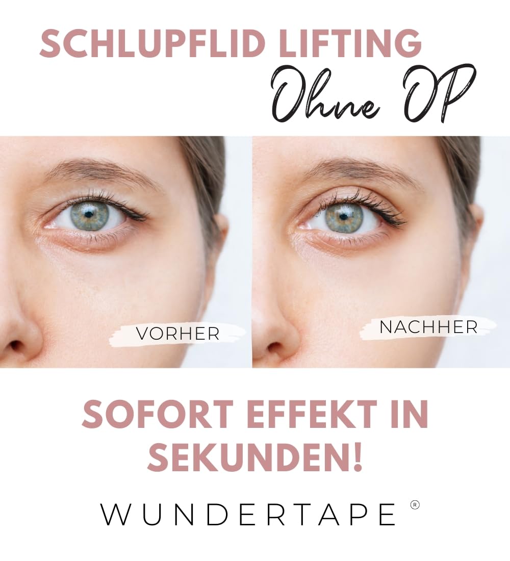WUNDERTAPE Tiras de párpados deslizantes para levantar párpados sin cirugía (impermeable, invisible, 24 horas de duración, eyelid tape), rayas invisibles (144 x XXL)