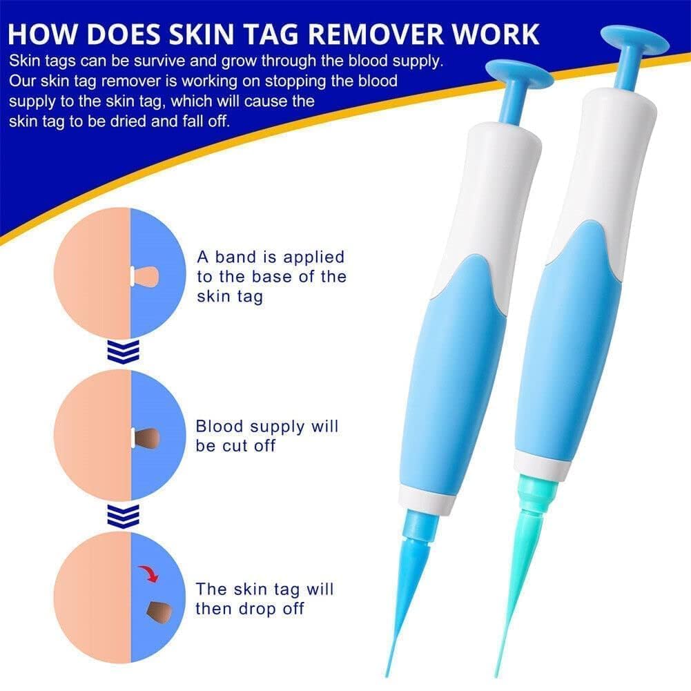 Skin Tag Remover Kit with 40 Bands (2mm-8mm) - Automatic Fast Acting Safe Skin Tag Remover Tool, Wart Removal, Skin Mole