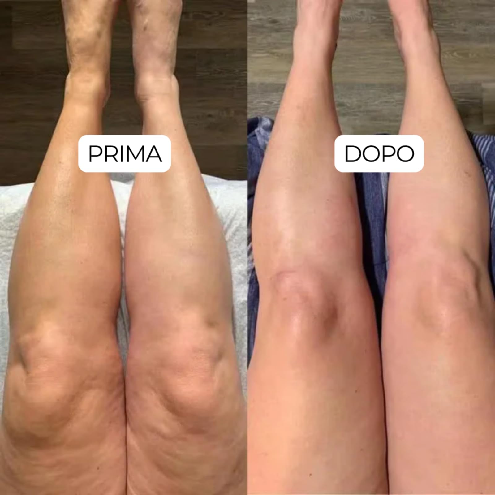 Linea Drenaggio Linfatico,Antidotti Drenanti Linfatici in Gocce,Formula Liquida ad Assorbimento Rapido,Componenti Naturali,Adatti per Uomini e Donne,Integratore per il Benessere Quotidiano (3PC)