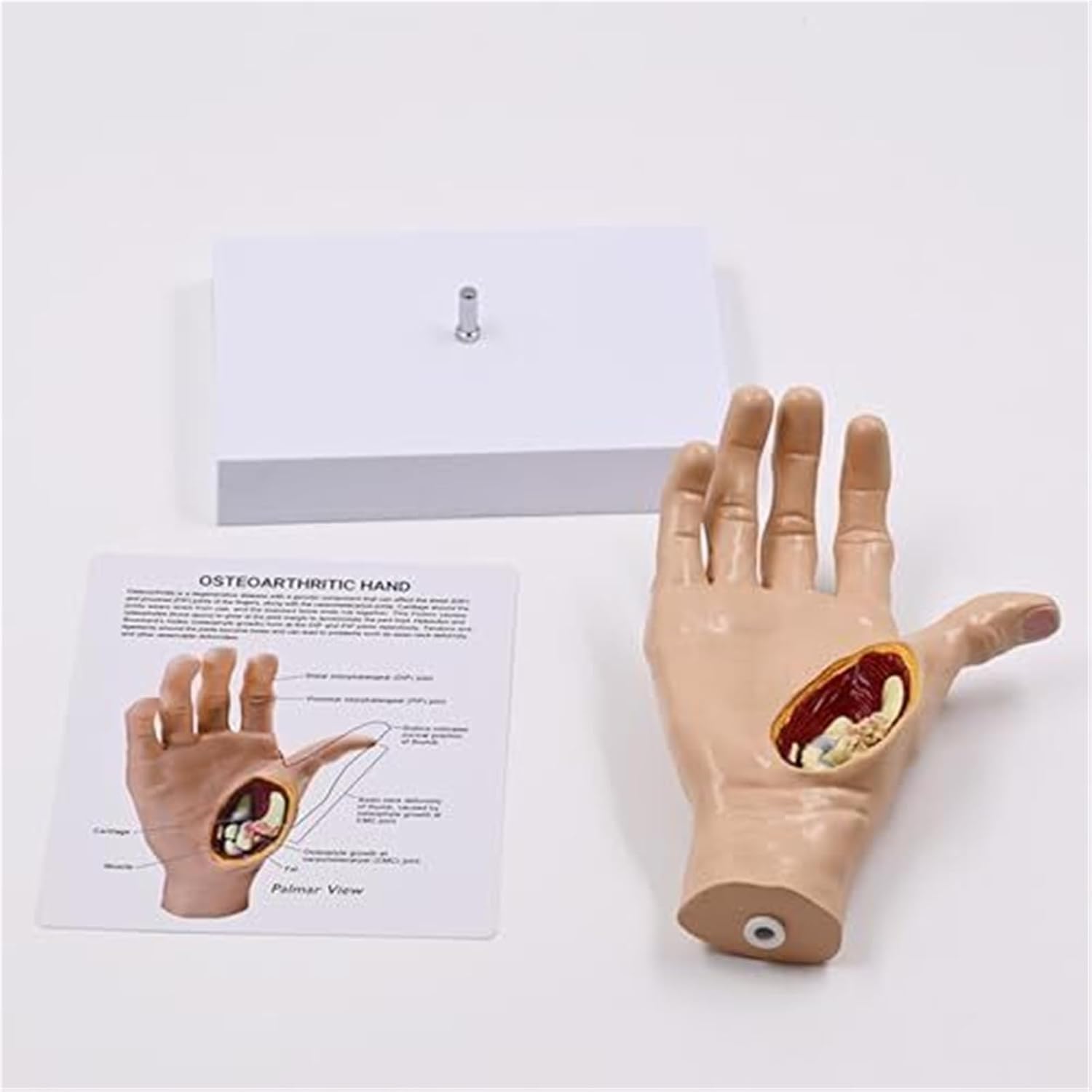 Teaching Aids for Anatomy of Hand Bones and Joints, Right Hand Tendons, Ligaments, Muscles, and Pathological Deformities of The Hand Skeleton