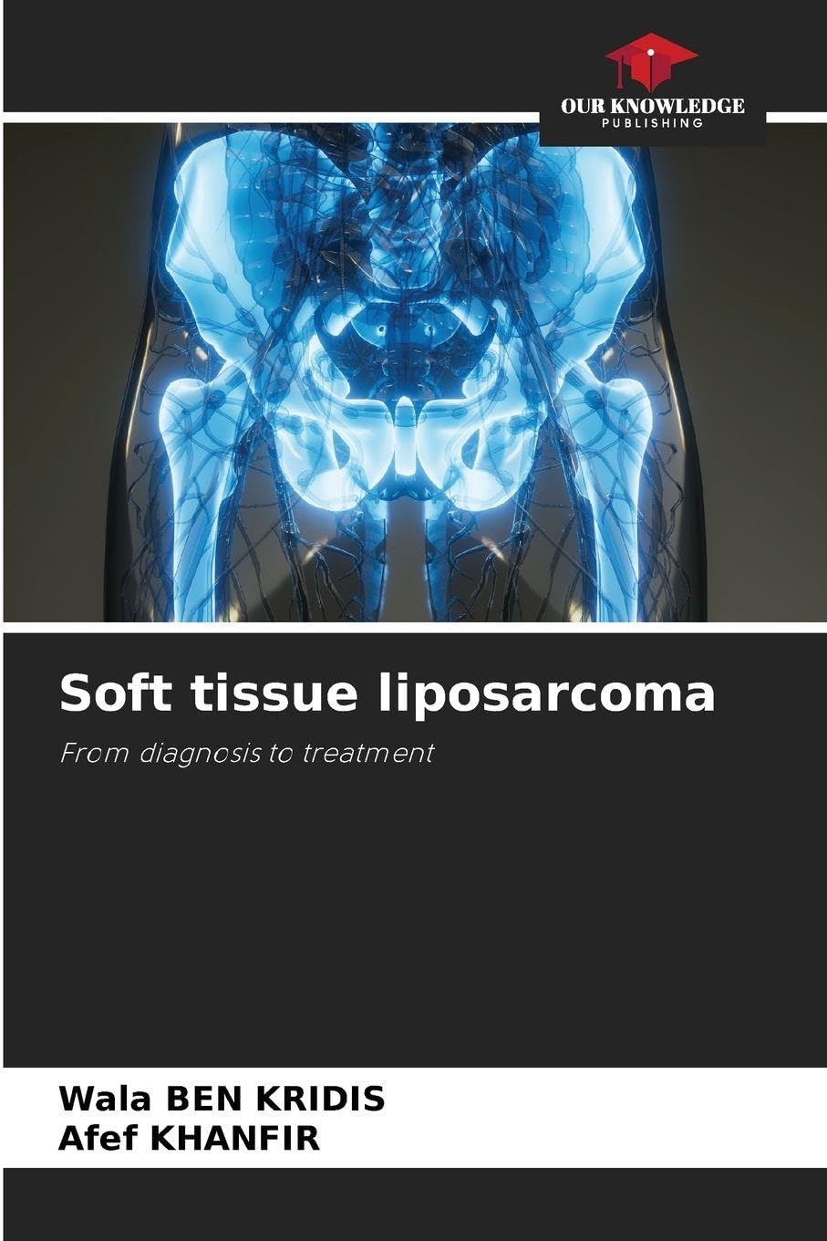 Soft tissue liposarcoma: From diagnosis to treatment