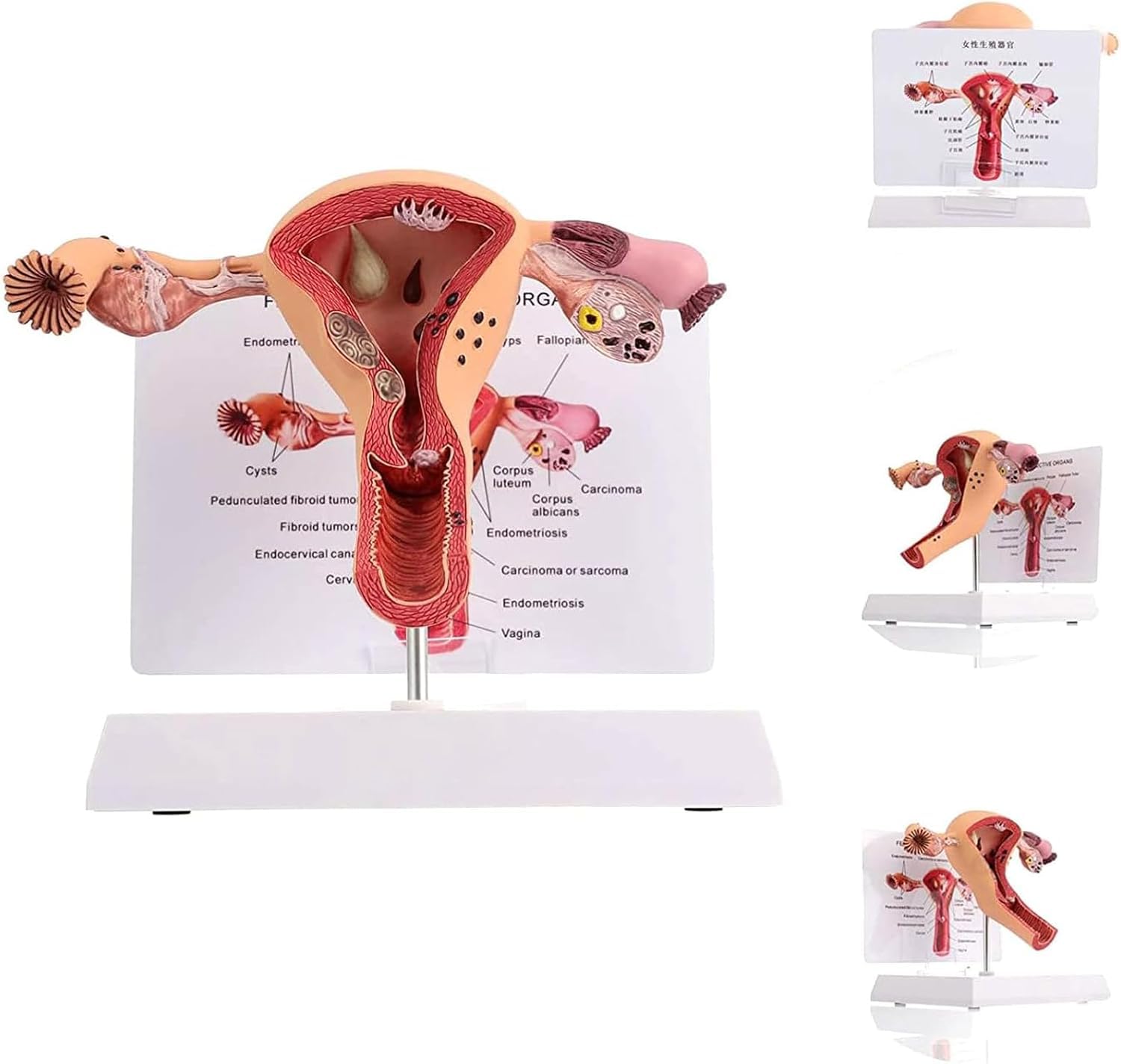 Modello del sistema riproduttivo femminile umano - Modello 3D di anatomia dell'utero e dell'ovaio per insegnamento e apprendimento, strumento educativo per studenti e professionisti sanitari