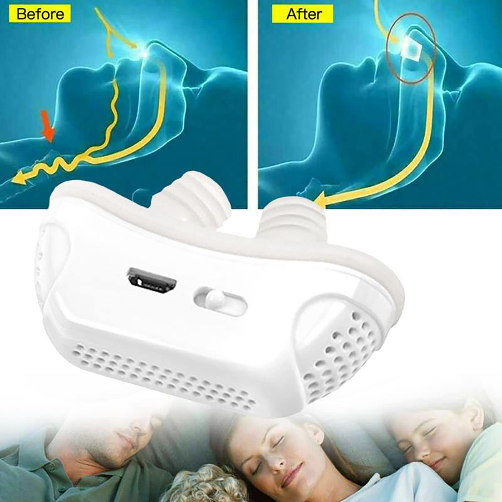 Dispositivos antirronquidos, Mini tapón para Respirar en la Nariz, Alivia los ronquidos, Tapones eléctricos de ventilación para la Nariz, Carga USB, Funda de Silicona extraíble, para facilitar el su
