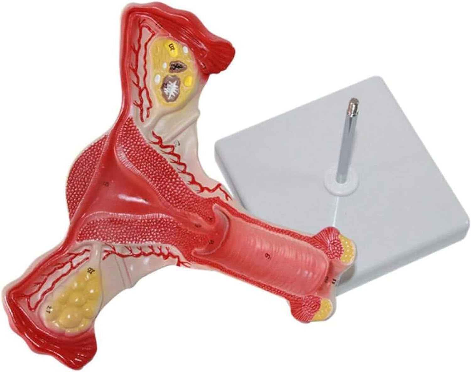 Modelo anatómico de anatomía, lesión uterina, Modelo de anatomía de órganos Humanos con órganos extraíbles para la enseñanza, Aprendizaje y exhibición de órganos.