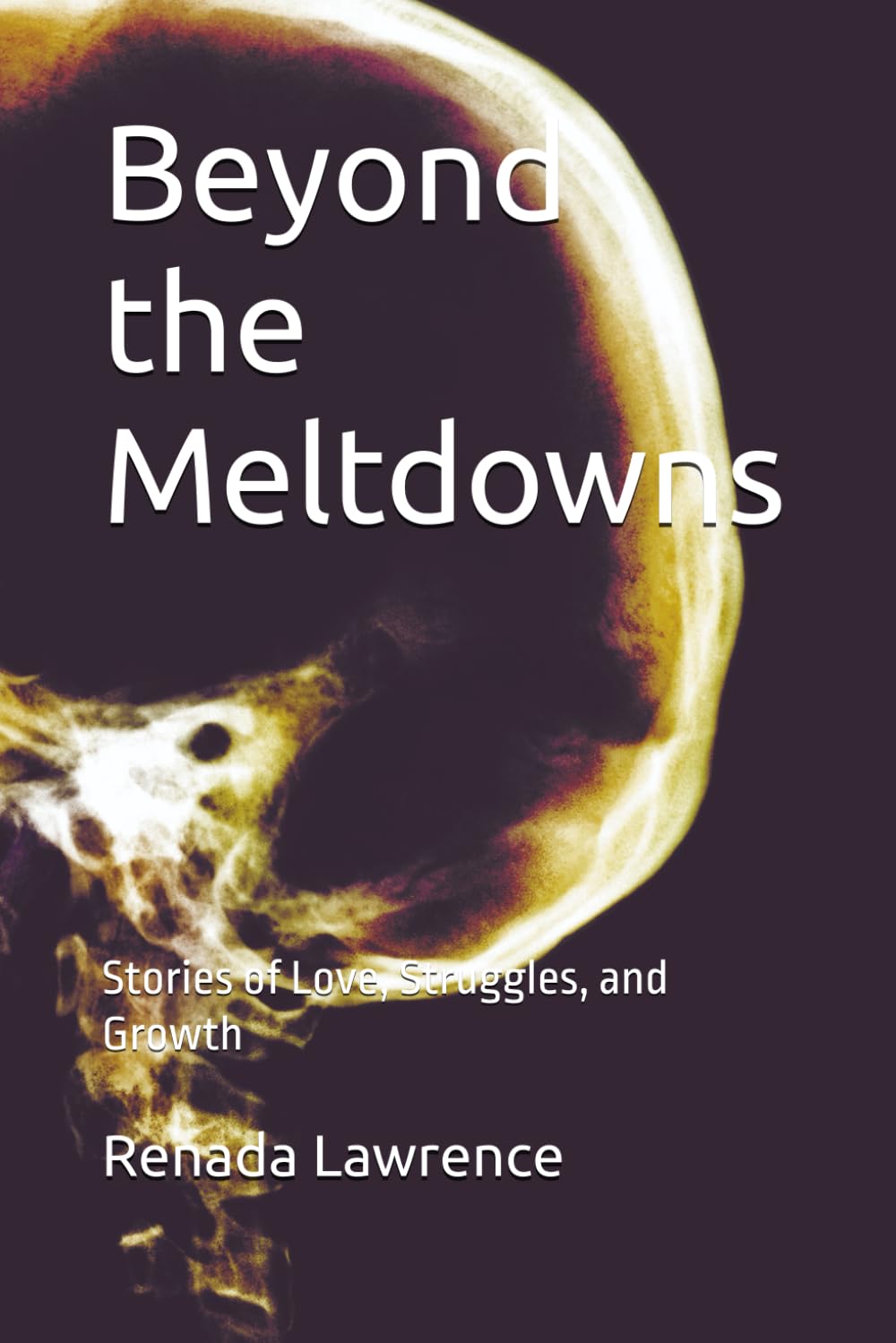 Beyond the Meltdowns: Stories of Love, Struggles, and Growth