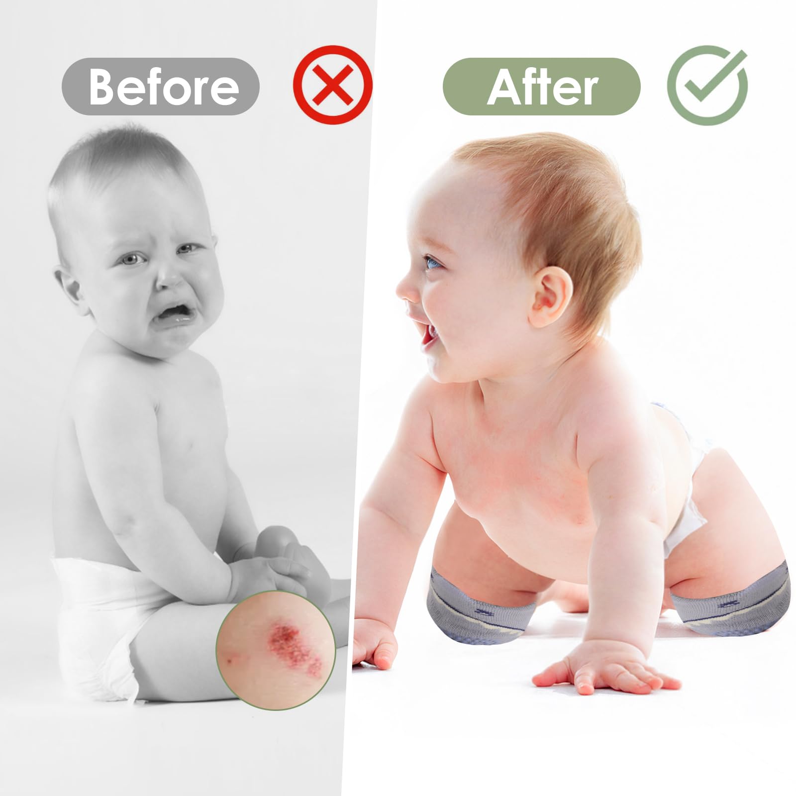Baby Knieschoner (5 Paar) für Krabbeln, Kleinkinder, Lauflernhilfe, Knieschoner für Jungen und Mädchen, 3 6 12 Monate alte Babys müssen haben