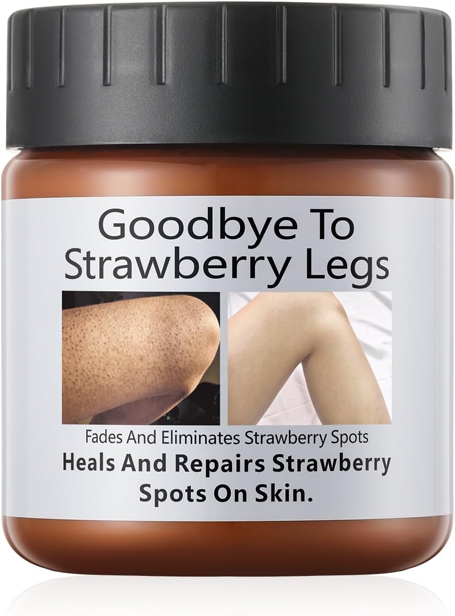 Strawberry Legs Treatment, Niacinamide Strawberry Arm Skin Resurfacing Cream, Hydrating Chicken Skin Treatment Keratosis Pilaris Treatment Moisturizing Body Moisturizer For Women Men 4.2 Floz