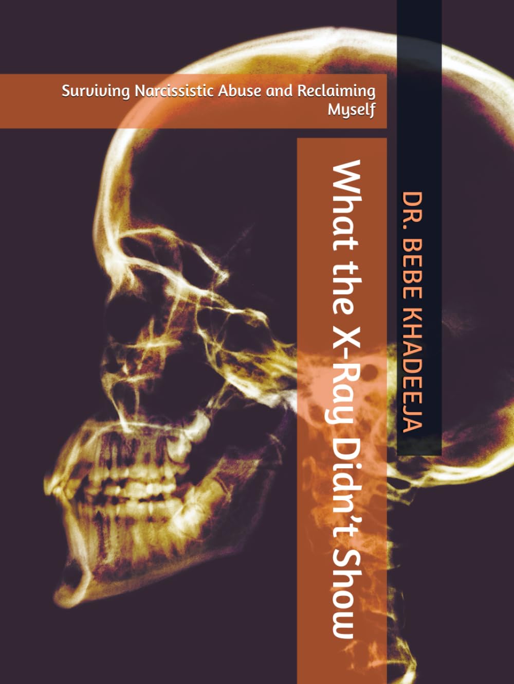 What the X-Ray Didn’t Show: Surviving Narcissistic Abuse and Reclaiming Myself