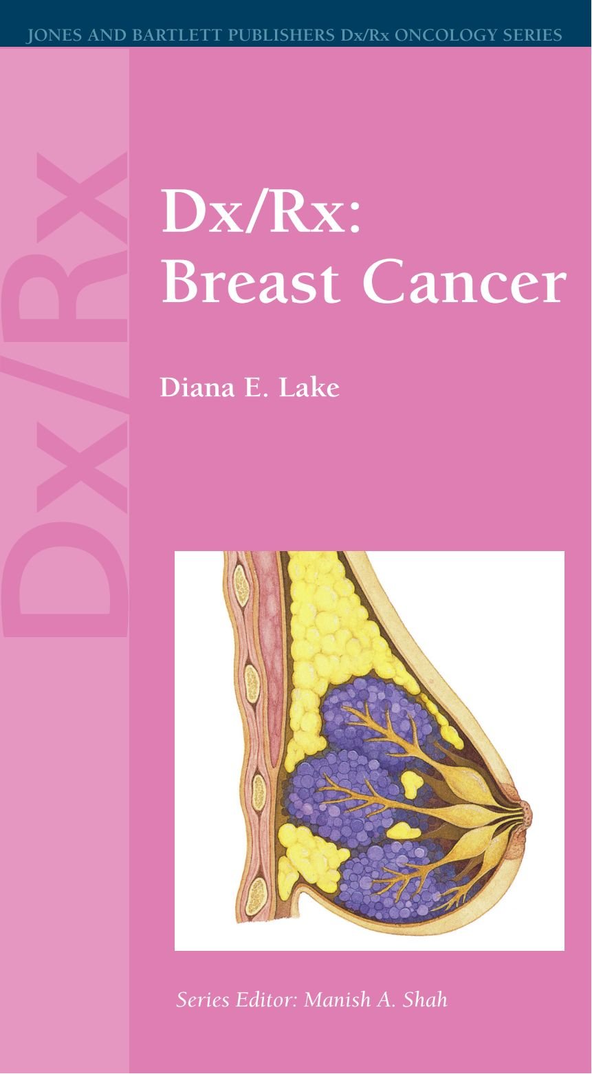 Dx/rx: Breast Cancer (Jones and Bartlett Publishers DX/RX Oncology)