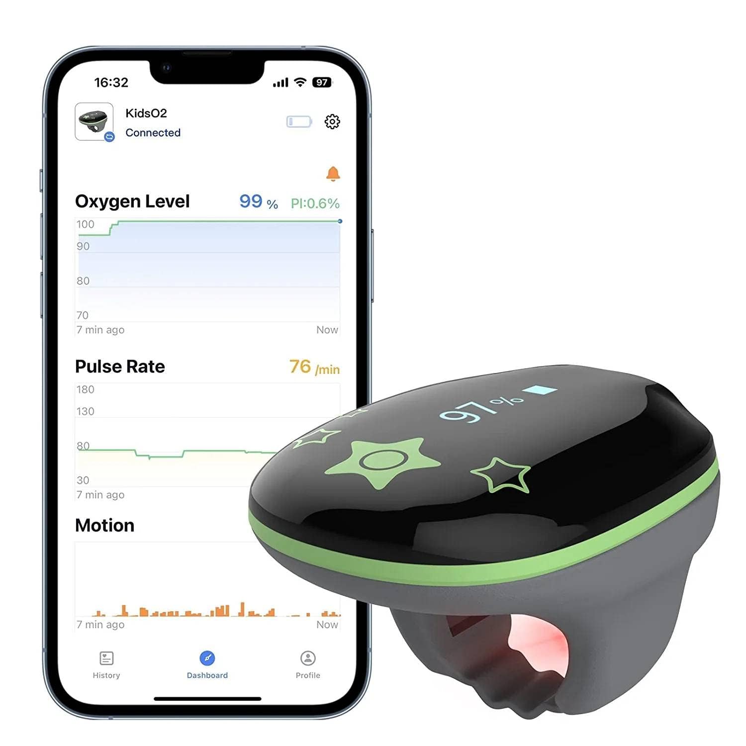 Viatom Oxímetro Pediátrico KidsO2, Monitor de Oxígeno Portátil para Niños, Medidor de Sueño Bluetooth con APP e Informe PC, Sensor de Pulso Spo2 Portátil