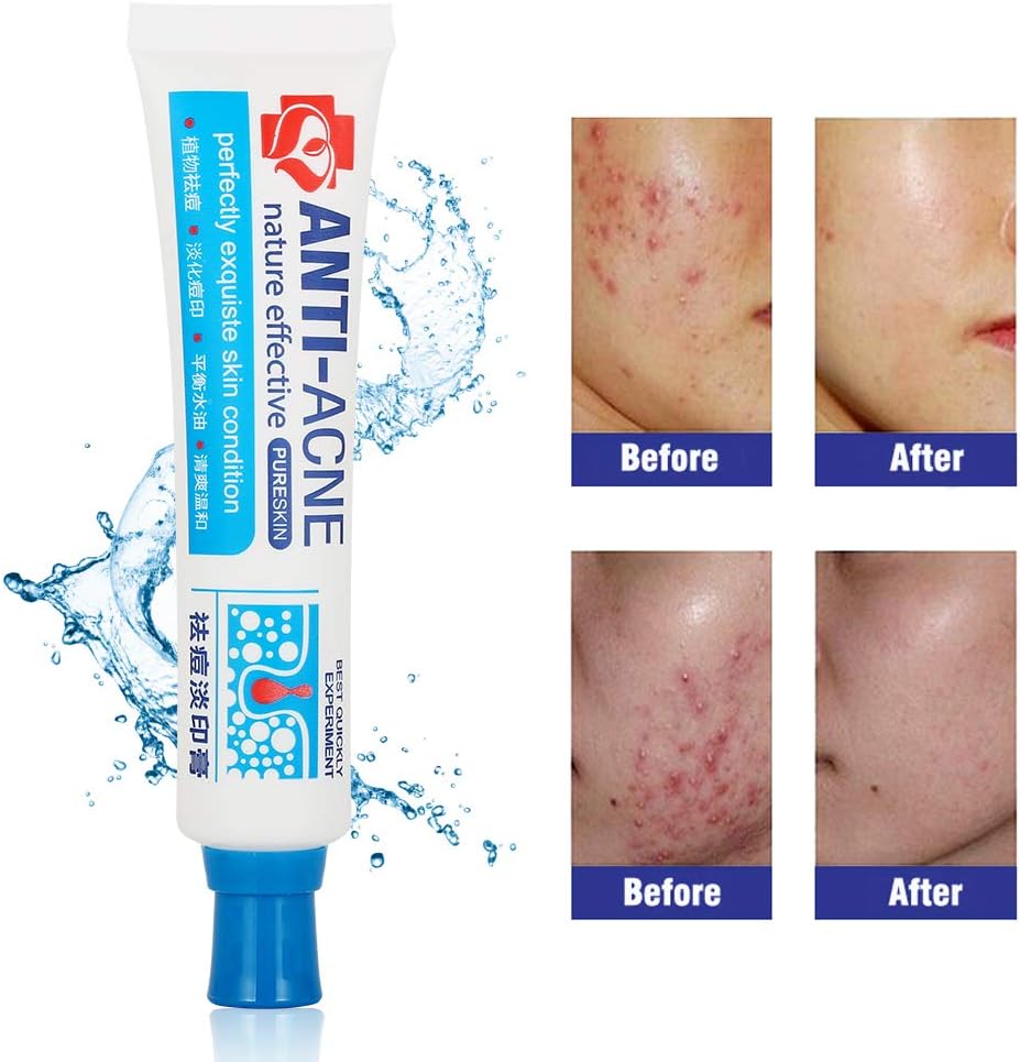 Derma Care System Titanium Needles Kit 4-in-1 with PINS (0.5mm, 1.0mm, 1.5mm) wrinkles, sun damage, acne scars, stretch marks, cellulite