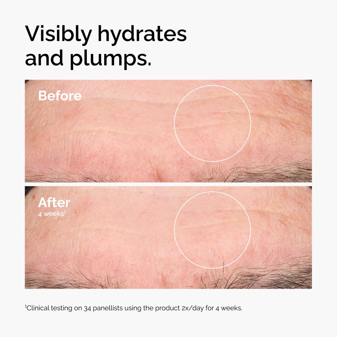 The Ordinary Hyaluronic Acid 2% + B5 (with Ceramides), Multi-Depth Hydration Serum for Plumper, Smoother Skin — Amazon image 2