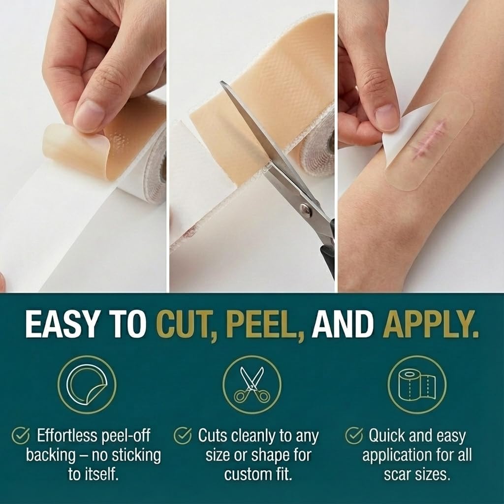 Silicone Scar Tape Roll (60" x 1.6") for Surgical & C-Section Scars