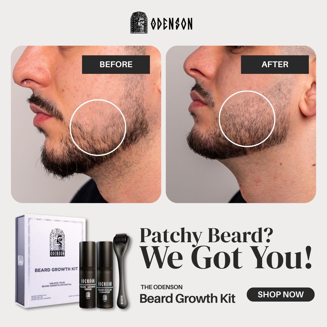 Odenson Zestaw na Porost Brody- Serum na Porost Brody dla Gęstszej i Grubszej Brody - Derma Roller do Wzrostu Włosów na Twarzy dla Mężczyzn - Spray do Czyszczenia Derma Rollera