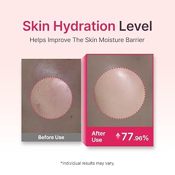 Starting Rose Galactomyces Essence Toner, Hydration & Glow (5.07 fl oz)
