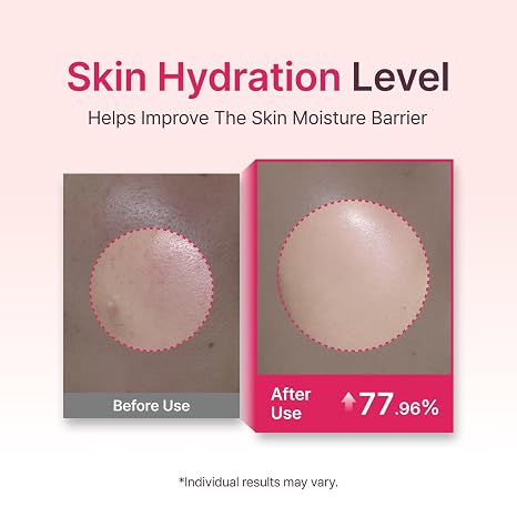 Starting Rose Galactomyces Essence Toner, Hydration & Glow (5.07 fl oz)