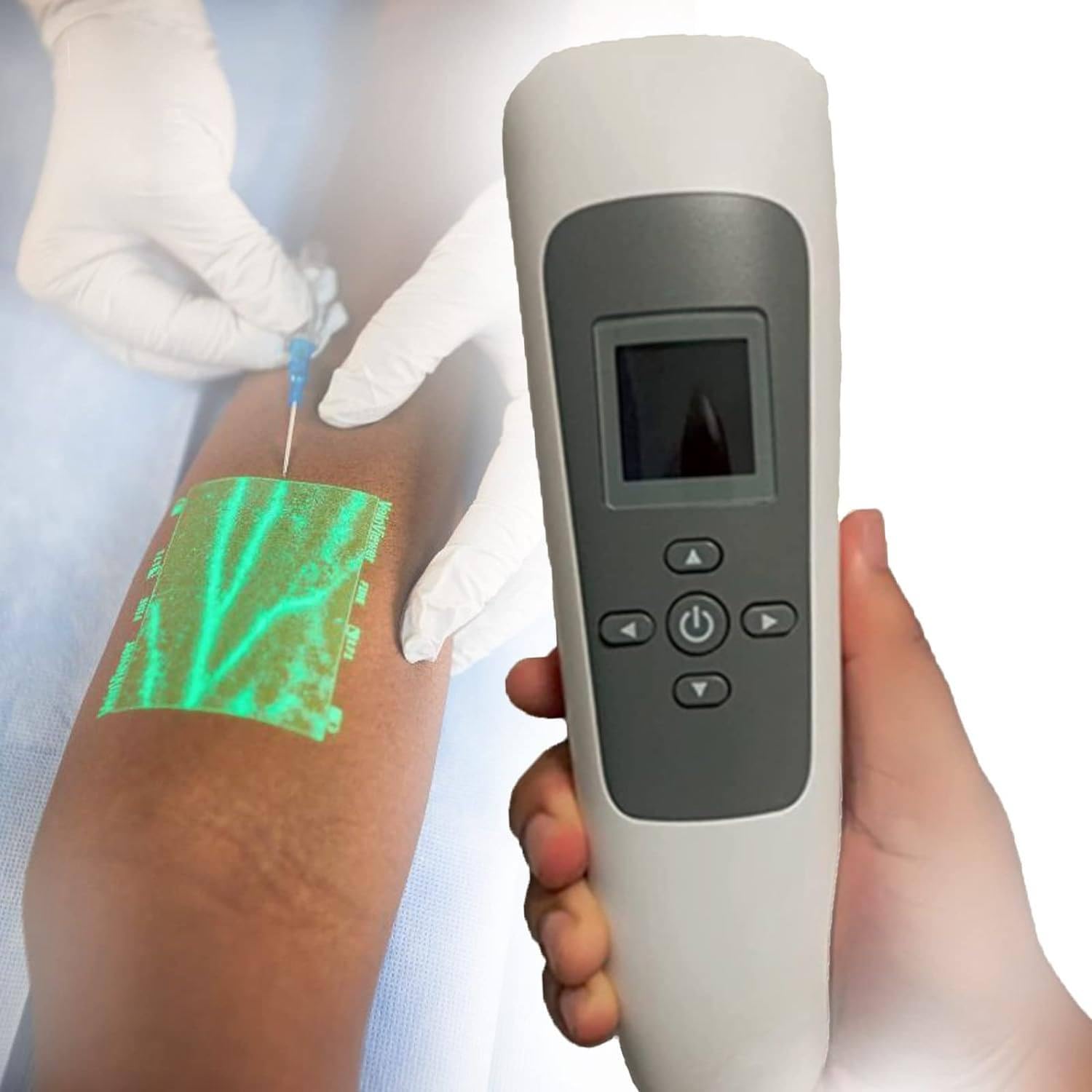 Amazon.co.jp: Infrared Vein Finder Viewer Portable Vein Detector