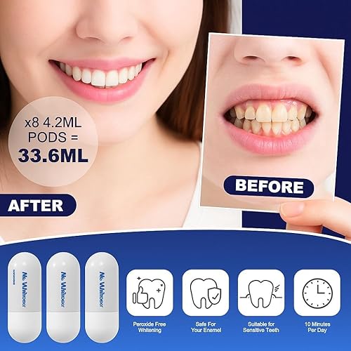 Miniatura 3 de Kit de blanqueamiento dental Luz LED para dientes sensibles, recomendado por dentistas, esmalte seguro, blanqueador profesional de dientes de