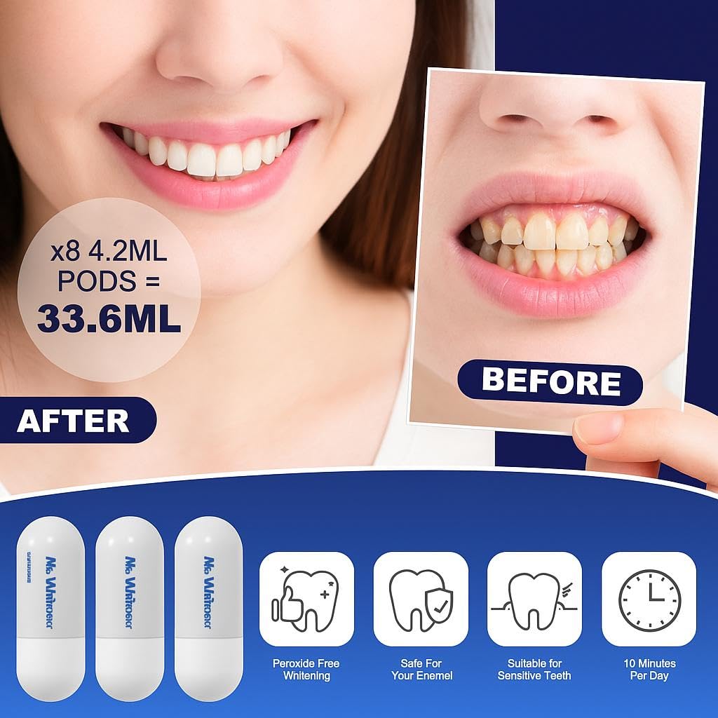 Kit de blanqueamiento dental LED, recomendado por dentistas, seguro para esmalte, blanqueador profesional de dientes para dientes sensibles, 8 cápsulas de gel de repuesto profesionales de