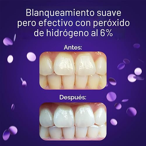 Burst - Tiras blanqueadoras dentales para dientes sensibles (Menta) | 20 tiras/10 tratamientos – Cada una con 1 superior/1 inferior | Resultados