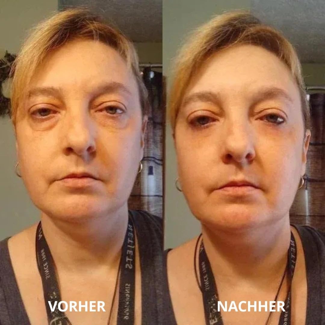 Solve Beauty, Peptid-Kollagen Hydrogel-Augenpads, solvene beauty augenpads mit Niacinamid Koffein Hyaluron, kühlende eye patches für frischer wirkende Augenpartie, 60 Stück Hydrogel Augenmaske