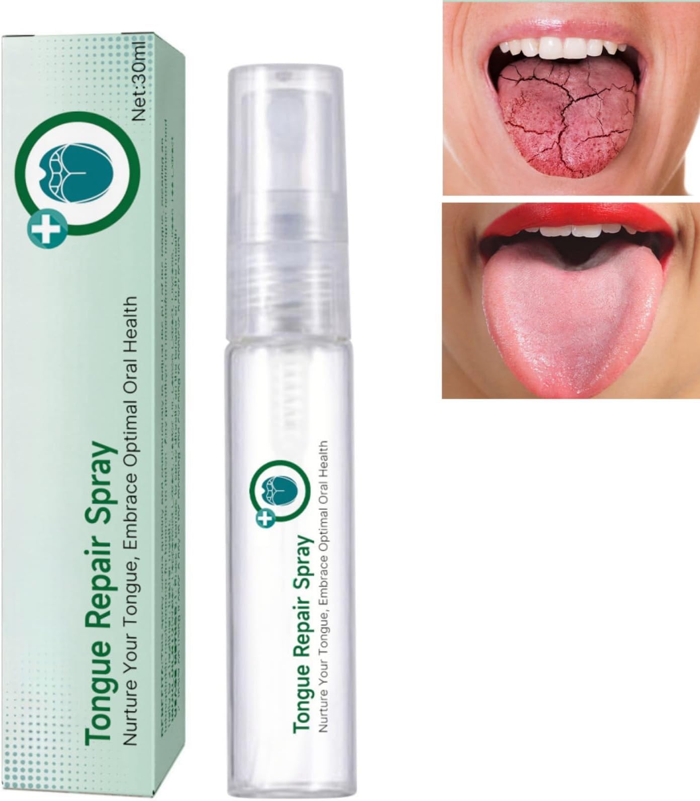 Tongue Repair Spray,Instant Dry Mouth Relief,Fissured Tongue Relief Spray,Sore Tongue Re/LIEF Mint Breath S/Pray,Breath Freshener for Dryness& Bad Brea/th