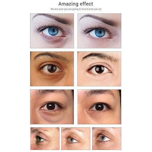 Miniatura 8 de Jakuva - Parches para debajo de los ojos (30 pares), mascarilla de colágeno para ojos hinchados, reducción de ojeras, líneas finas e hidratación,