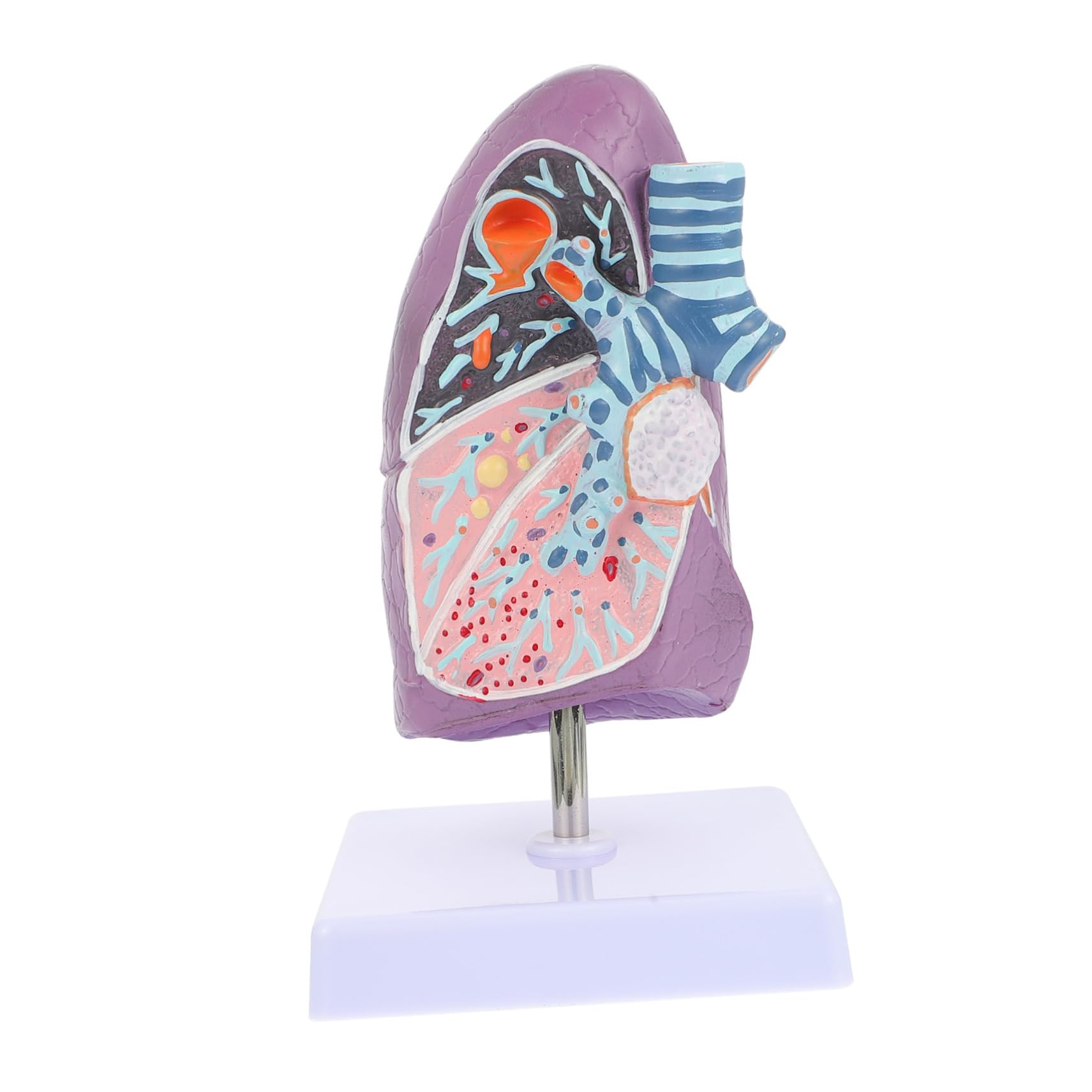 Modèle Pulmonaire D'anatomie Pathologique pour Enseignement Médical