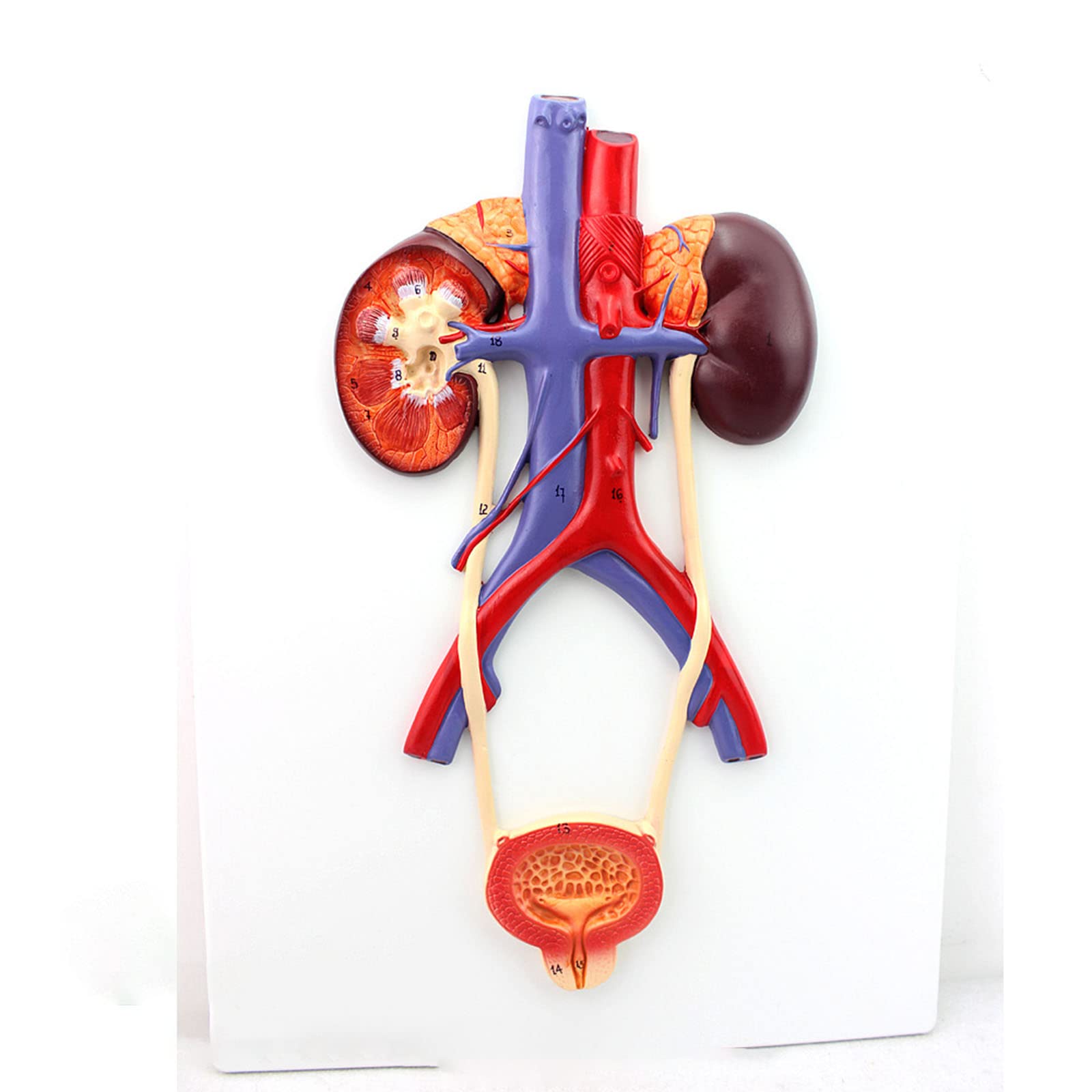 GTHTUHFD Human Model Human Bladder Catheterization Renal Urinary Modelkidney Model Arteriovenous Model