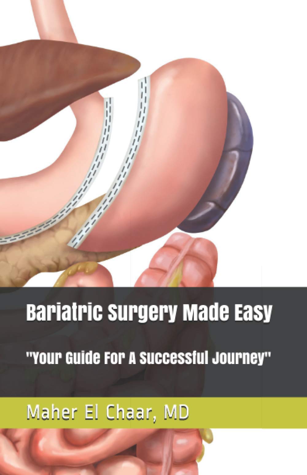 Bariatric Surgery Made Easy:: Your Guide For A Successful Journey Paperback – September 7, 2020