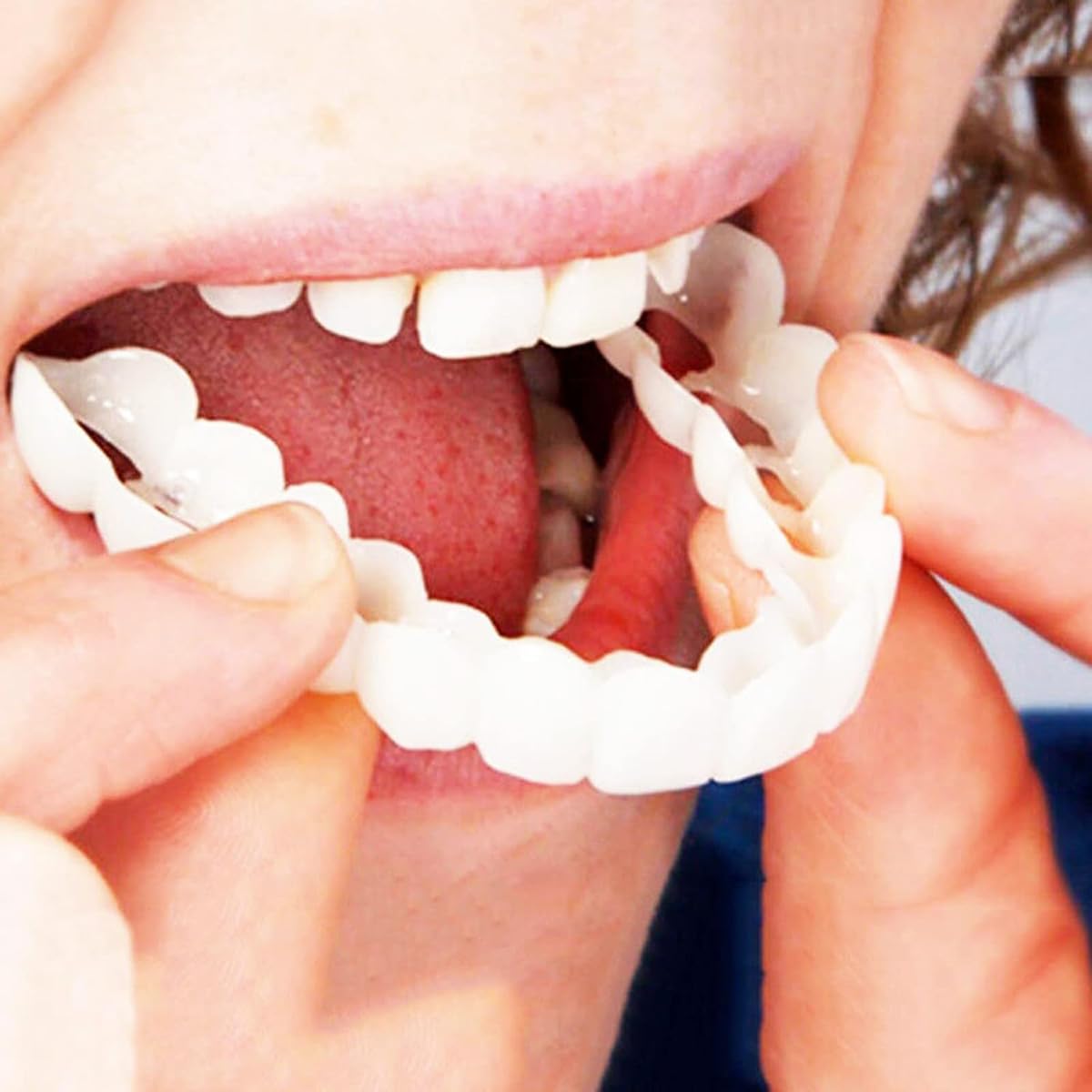 2 Prothèses Dentaires Cosmétiques - Fausses Dents Blanches - Accessoire Déguisement