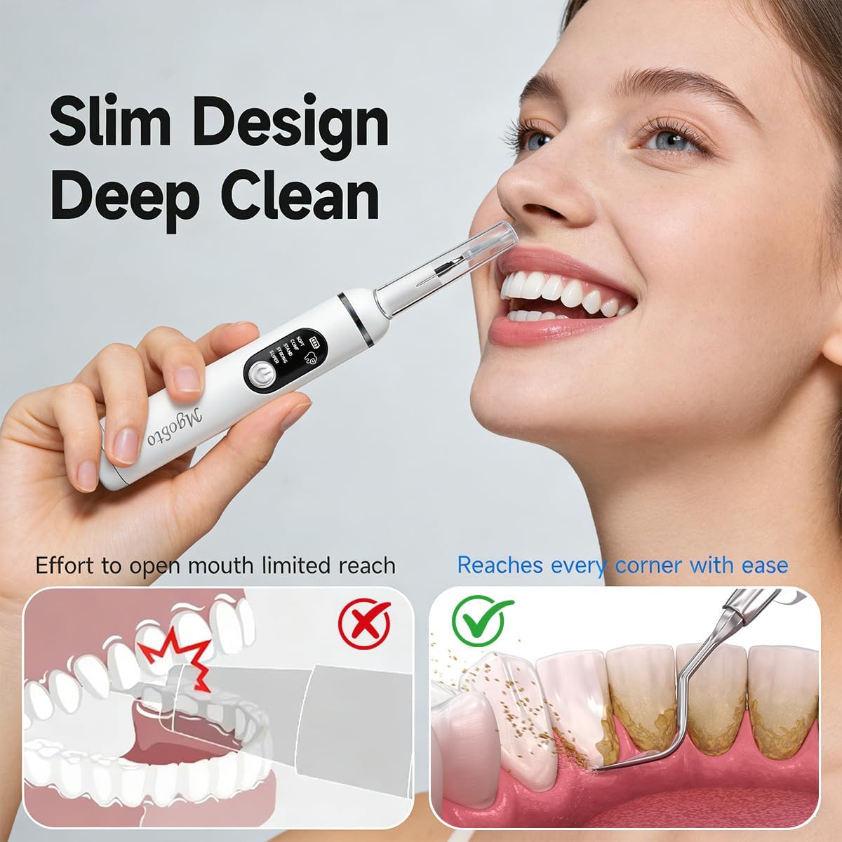 Ultimate Electric Teeth Cleaner - Ultrasonic Tooth Cleaning, Violet Light Protection, 316F Stainless Steel Heads, 5-Speed Modes, IPX6 Waterproof, Oral Care Kit with 11 Accessories‌ (White)