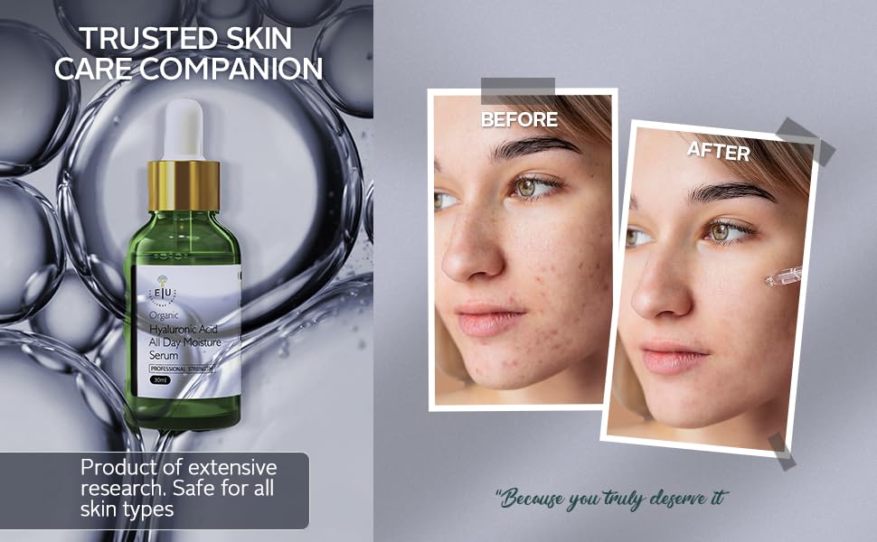 Miniatura 8 de Excellence Retinol único, ácido hialurónico y vitamina C