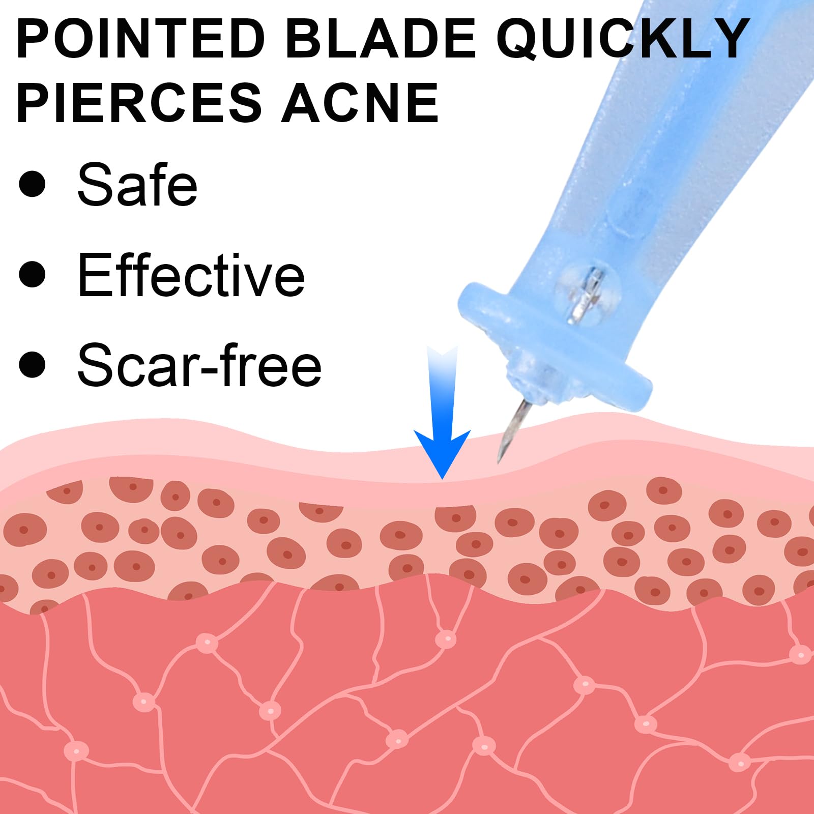 100pcs Pimple Needles and 72 Dots Acne patches, Blackhead Blemish Remover Safe Effective Removal Acne Pimple Extraction Needle for Beauty Face Skincare Tool - Image 4