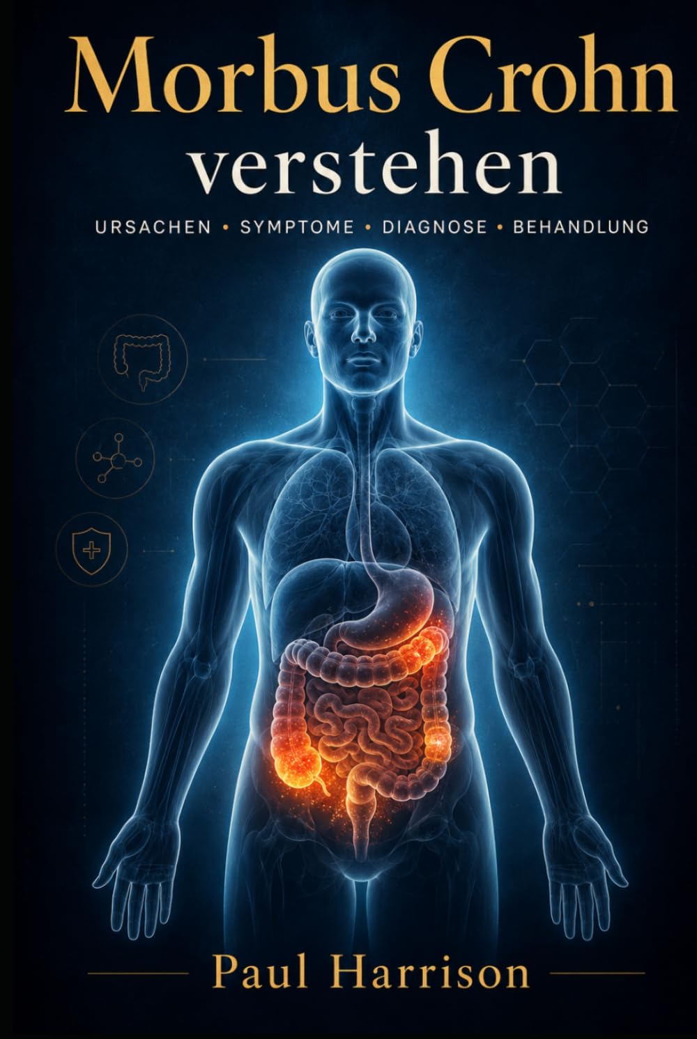 Morbus Crohn Verstehen (Seltene Krankheiten verstehen)