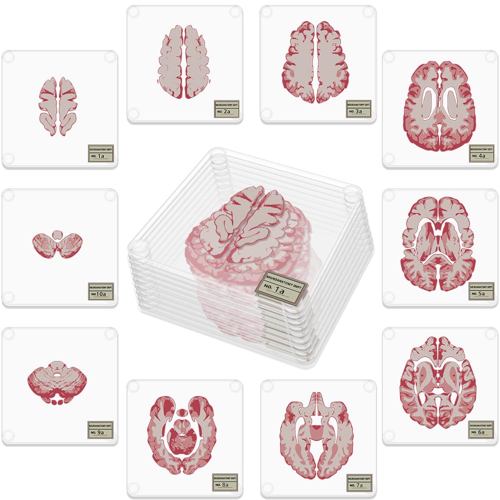 Amazon.com: Timethink (Set of 10) 4'' 3D Brain Specimen Coasters