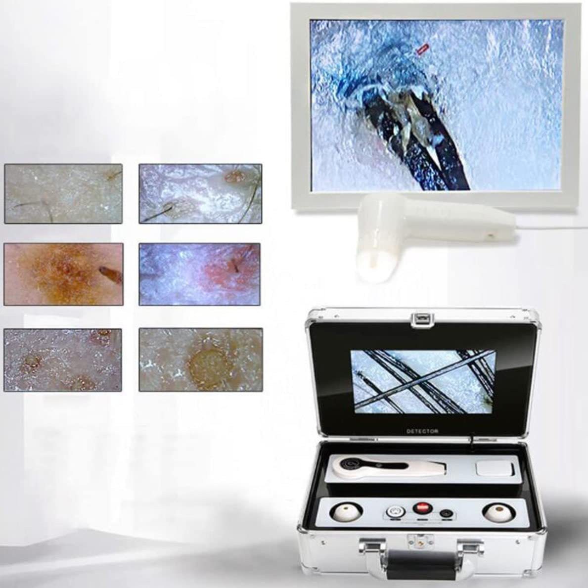 Analysegerät für Haare und Haut, 22,9 cm (9 Zoll), LCD-Display, Analysegerät für Haarfollikel, multifunktionales Analysegerät, einfache Bedienung für Ana
