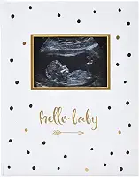 Livro de memórias do bebê Pearhead, para os primeiros 5 anos, poá preto/dourado