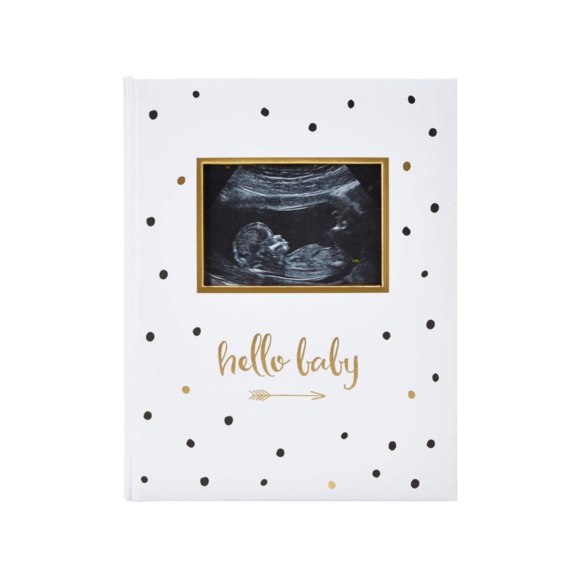 Pearhead First 5 Years Baby Memory Book with Sonogram Photo Insert, Black and Gold Polka Dot, Baby Keepsake Memory Book, Hello Baby BabybookPearhead First 5 Years Baby Memory Book with Sonog…