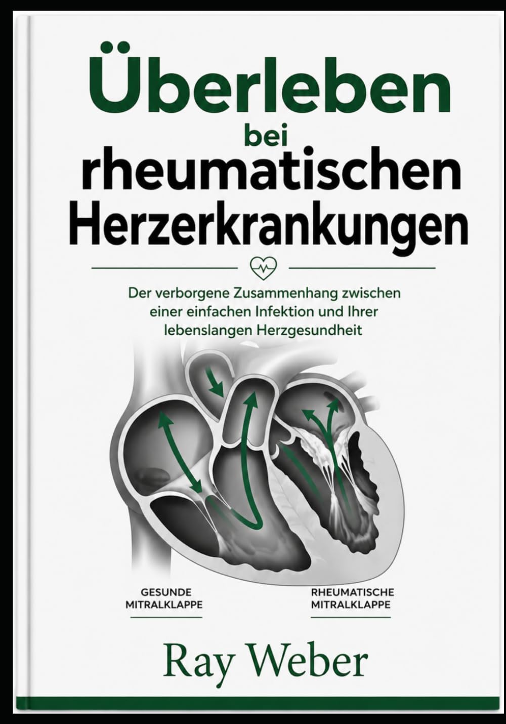 Überleben bei rheumatischen Herzerkrankungen: Der verborgene Zusammenhang zwischen einer einfachen Infektion und Ihrer lebenslangen Herzgesundheit ... dein Herz. Schütze dein Herz. Lebe länger.)
