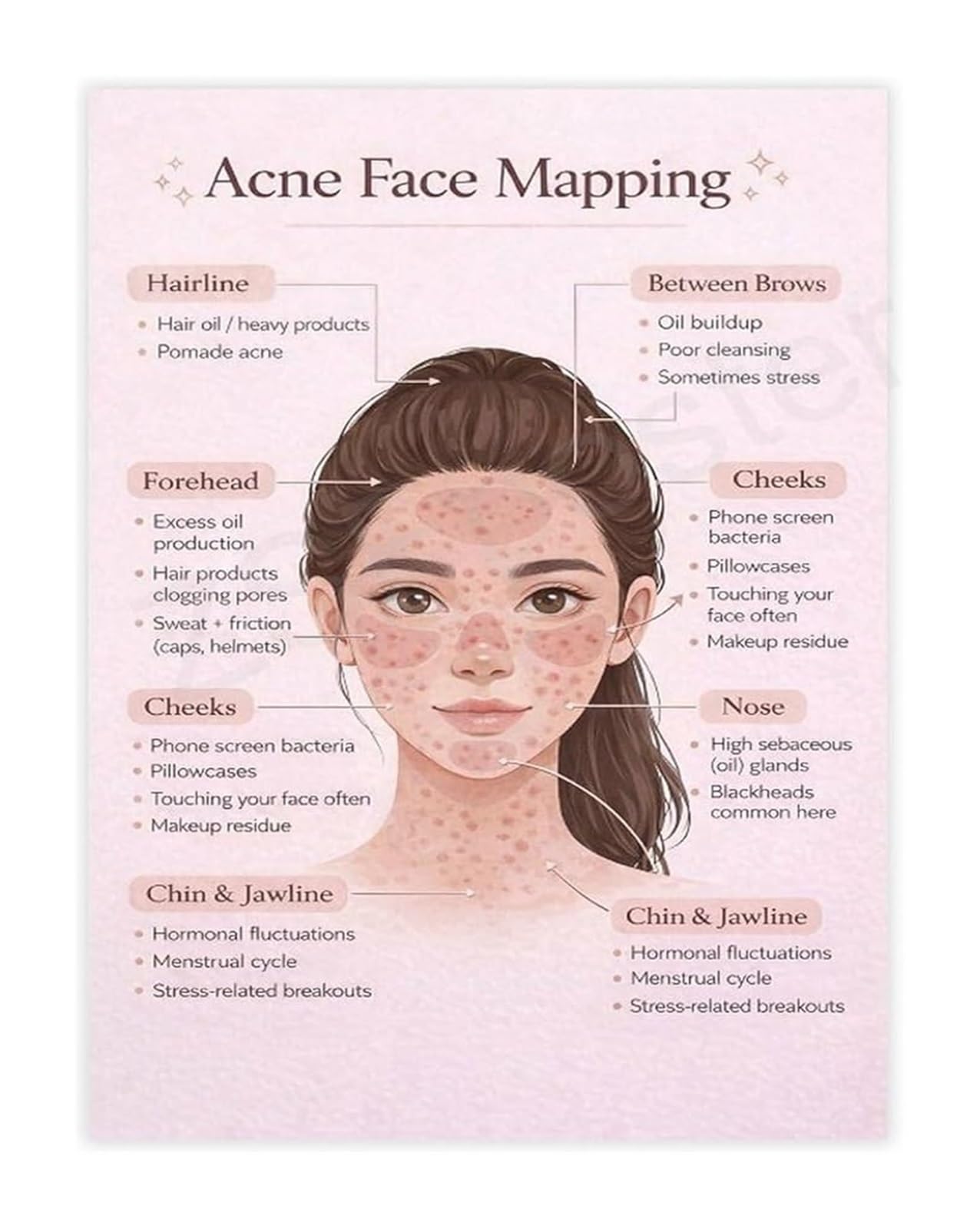 UYCUODLUY Acne and Breakout Face Mapping Chart Poster Skincare Routine Guide Canvas Wall-Art for Home Bathroom Decor(Unframed,12x18inch(30x45cm))