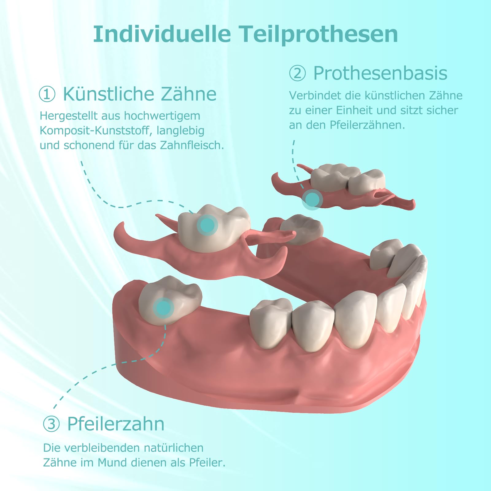 Maßgefertigte Teilprothese für Zahnlücken – Herausnehmbarer Provisorischer Zahnersatz für Frauen Männer, Zahnprothese mit perfektem Sitz. Einfache Anwendung für Ihr perfektes Lächeln zu Hause (1 Zahn)